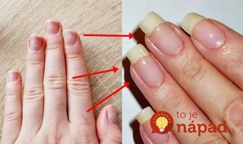 Táto domáca zmes opravila poškodené, slabé a lámavé nechty za 10 dní: Odporúčam každému, kto má tento problém – rastú omnoho rýchlejšie!